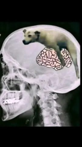 เมื่อวานไปเอกซเรย์สมองมา และสิ่งที่อยู่ในสมองของผม