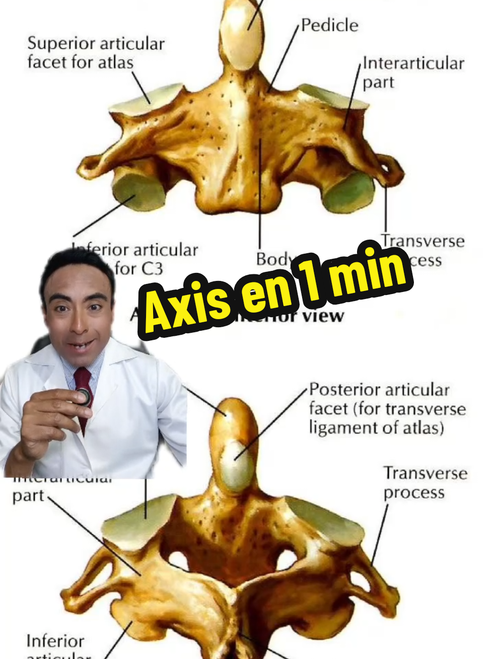 Axis (C2)👨🏼‍🏫 - Se caracteriza por su proceso odontoideo. - En la región superior se articula con el atlas y en la región inferior se articula con C3. - Su Proceso espinoso es corto y bifido. #medcialstudent #anatomy #anatomia #medicina #docencia #nevergiveup #foryoupage #fyppppppppppppppppppppppp 