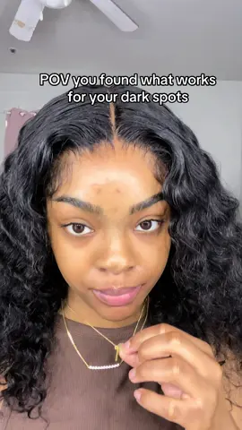 #fyp #darkspots #anuasuperbrandday #darkspotserum @Anua Store US 