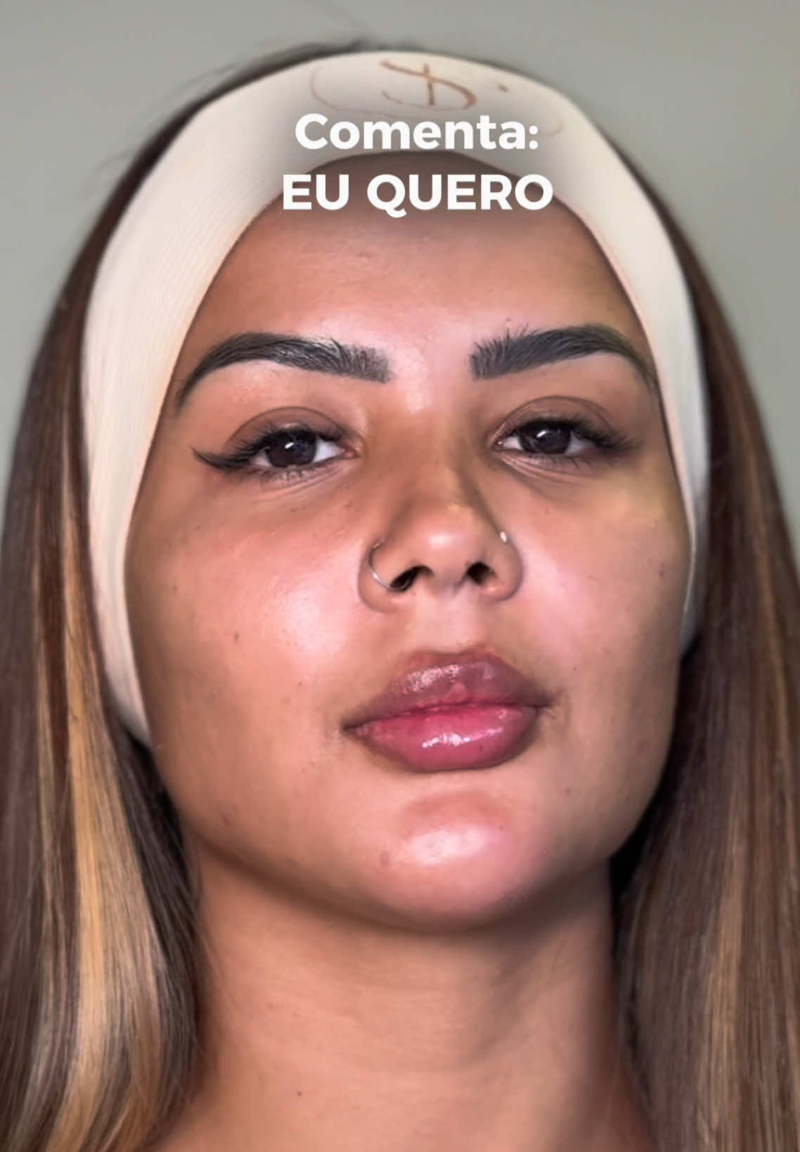 Comente “EU QUERO” para mais informações 😍 #saopaulo #harmonizaçãofacial #harmonizacaofacialsp #sp #fyp 