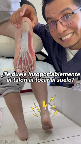 ¿Fasciitis plantar? ¡Alivio fácil ahora!#painrelief #clearzal #clearzalgel 