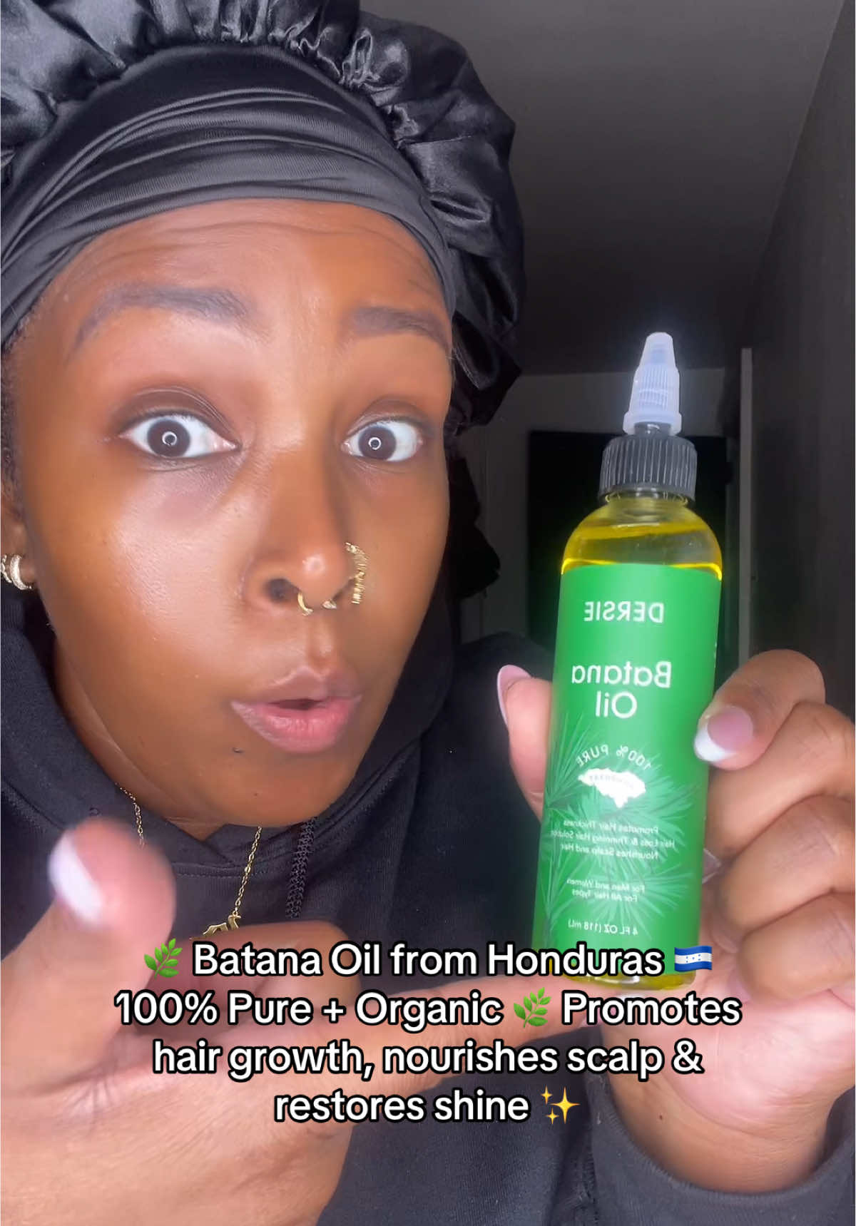 Transform your hair with Dr. Sebi’s Organic Raw Honduras Batana Oil. Known as a natural treasure from Honduras, this pure oil helps stimulate hair growth, repair damaged strands, and deeply nourish your scalp. Whether you’re battling dryness, thinning edges, or want to bring back your hair’s natural shine, Batana Oil is a holistic solution trusted for generations. Liquid + paste formula gives you versatility for treatments that work. 🌸