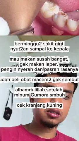 sakit gigi gusi bengkak sampai pusing ke kepala? susah buat makan. pakai ini sesekali tetes sakit gigi hilang#gumoraobatsakitgigi #gusibengkak #obatsakitgigi #gratisongkir #fyppppppppppppppppppppppp 