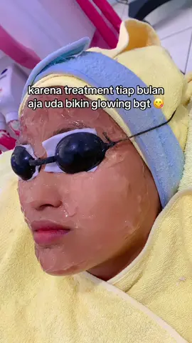 #xyzbca #likeforlike #blackdoll #fyp #treatment #klinikkecantikan #eyestreatment #perawatantanahmerah #bangakalan #tanahmerah #iplrejuvenation 