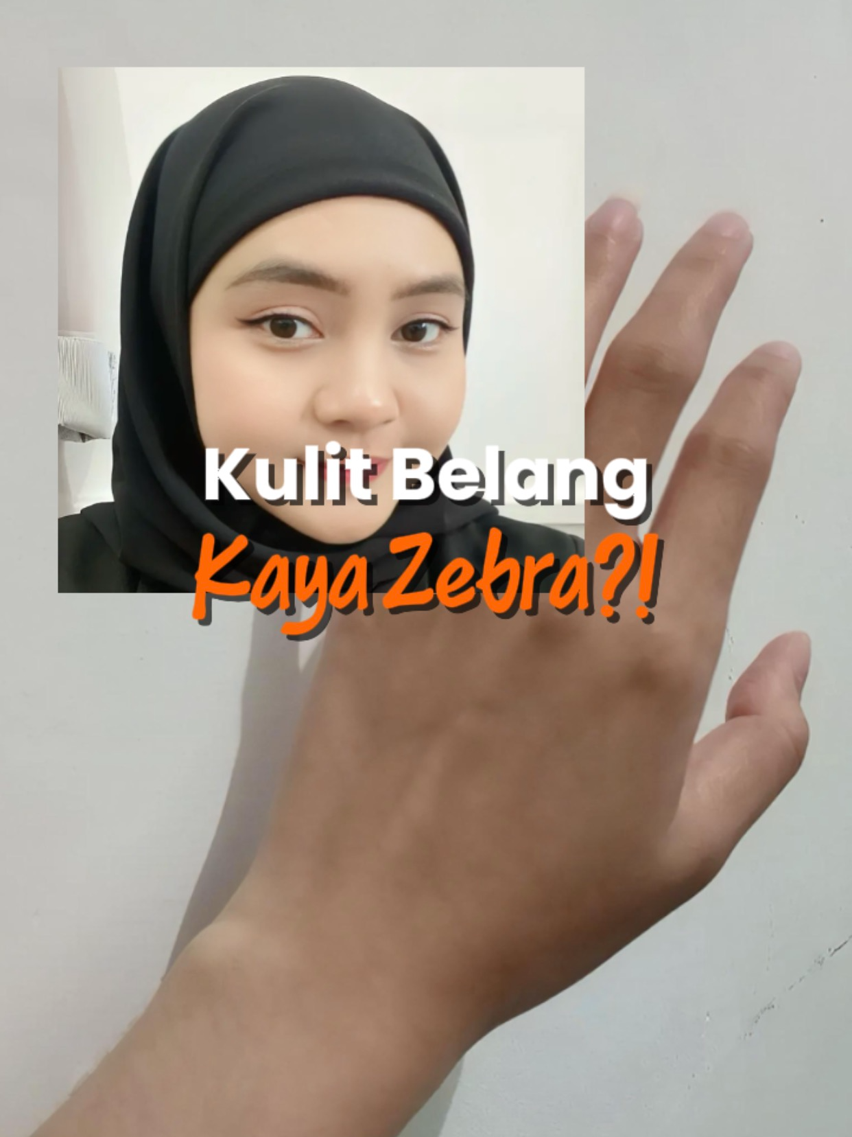 Kulit belang, susah putih, gampang kusam, sini deh buruan🥹 #kolagen #glutathione #susahputih #colagold