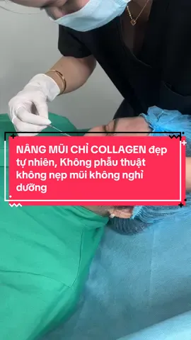 #nangmuichi #nangmuichicollagens #nosethread 