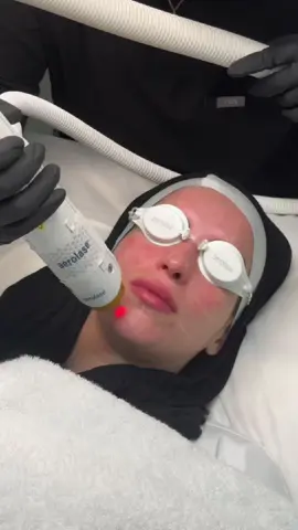 That fresh-from-the-clinic glow. ✨ After peels, lasers or facials you’ll notice immediate radiance as circulation improves and dead cells slough away — the skin reveals a fresher, healthier layer.  Maintain that luminosity with gentle hydration and sun protection to prolong the effect.  🟩 Boosted circulation = instant radiance 🟩 Hydration locks in the post-treatment glow 🟩 SPF preserves results and prevents pigment rebound 🟩 Follow therapist guidance to extend benefits Want this glow every month? Tap Book Now to design your maintenance plan. 💚 #PostTreatmentGlow #InstantRadiance #SkinRevival #DewyComplexion #BeautyClinic #SkinCareClinic #AestheticClinic #SkinHealth #PunchbowlNSW #SydneyBeauty #NSWBeauty #sydneyaustralia 