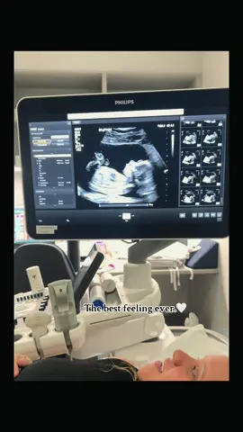 My testimony🥹❤️ god is good all the time #godisgood #pregnant #firsttimemom #blessings #fyp 