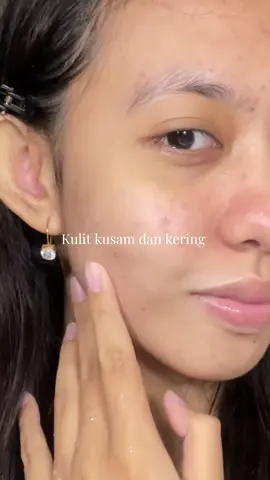 Ga takut lagi kalau kulit lagi kusam & kering  #chalonese #chaloneseskincare #chalonesetoner 