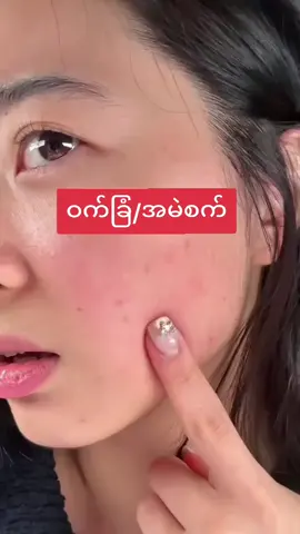 #3in1cherrymoistuer#MalThidar #hcproductsMDY #ကိုင်တိုင်းသုံးကြည့်ပီးမှပြန်ရောင်းတဲ့bran #အပိုဝင်ငွေရှာကြမယ်💵💵💵💸💸💸💸💸 