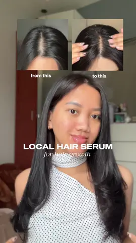 Setelah sering pake scalp active serum dari @HERITIER Indonesia ternyata sengaruh itu buat numbuhin rambutku!🤍✨💯🥹 #haircare #hairgrowth #hairserum #hairvitamin #hairfallsolution 