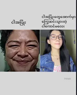 အဲ့သလို #foryou #myanmartiktoks #alinght_motion_edit_ #PRIME 