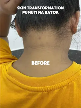 MAITIM NA BATOK? 𝙳𝚊𝚝𝚒 𝚝𝚒𝚗𝚊𝚝𝚊𝚐𝚘 𝚊𝚗𝚐 𝚋𝚊𝚝𝚘𝚔 𝚍𝚊𝚑𝚒𝚕 𝚜𝚊 𝚖𝚊𝚒𝚝𝚒𝚖 𝚊𝚝 𝚖𝚊𝚢 𝚍𝚒𝚜𝚌𝚘𝚕𝚘𝚛𝚊𝚝𝚒𝚘𝚗… 𝚙𝚎𝚛𝚘 𝚕𝚘𝚘𝚔 𝚊𝚝 𝚝𝚑𝚎 𝚙𝚛𝚘𝚐𝚛𝚎𝚜𝚜 𝚗𝚘𝚠!  💛  𝚃𝚑𝚊𝚗𝚔𝚜 𝚝𝚘 𝙿𝚛𝚎𝚝𝚝𝚢 𝙹𝚒𝚗 𝙴𝚡𝚝𝚛𝚎𝚖𝚎 𝚅𝚊𝚗𝚒𝚜𝚑𝚒𝚗𝚐 𝚃𝚘𝚗𝚎𝚛, 𝚞𝚗𝚝𝚒-𝚞𝚗𝚝𝚒𝚗𝚐 𝚗𝚊𝚐-𝚏𝚊𝚍𝚎 𝚊𝚗𝚐 𝚍𝚊𝚛𝚔 𝚜𝚙𝚘𝚝𝚜 𝚊𝚝 𝚖𝚊𝚜 𝚗𝚊𝚐𝚒𝚗𝚐 𝚎𝚟𝚎𝚗 𝚊𝚝 𝚐𝚕𝚘𝚠𝚒𝚗𝚐 𝚊𝚗𝚐 𝚜𝚔𝚒𝚗. 🌟   💛 𝙵𝚊𝚍𝚎𝚜 𝚍𝚊𝚛𝚔 𝚜𝚙𝚘𝚝𝚜 & 𝚍𝚒𝚜𝚌𝚘𝚕𝚘𝚛𝚊𝚝𝚒𝚘𝚗  💛 𝙴𝚟𝚎𝚗𝚜 𝚘𝚞𝚝 𝚜𝚔𝚒𝚗 𝚝𝚘𝚗𝚎  💛 𝚁𝚎𝚟𝚎𝚊𝚕𝚜 𝚊 𝚋𝚛𝚒𝚐𝚑𝚝𝚎𝚛, 𝚜𝚖𝚘𝚘𝚝𝚑𝚎𝚛 𝚐𝚕𝚘𝚠  𝙽𝚘 𝚖𝚘𝚛𝚎 𝚑𝚒𝚍𝚒𝚗𝚐 — 𝚕𝚎𝚝 𝚢𝚘𝚞𝚛 𝚌𝚘𝚗𝚏𝚒𝚍𝚎𝚗𝚌𝚎 𝚜𝚑𝚘𝚠! 🙌 Disclaimer: No copyright infringement intended. I do not own the music in this video. All rights belong to the rightful owner #prettyjin #extremevanishingtoner #bastaprettyjinamoybaby #pinakamabango #babyscented 