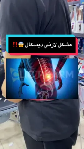 #إنزلاق_غضروفي_قطني #herniediscale #herniededisc #backpain #آلام_الظهر 