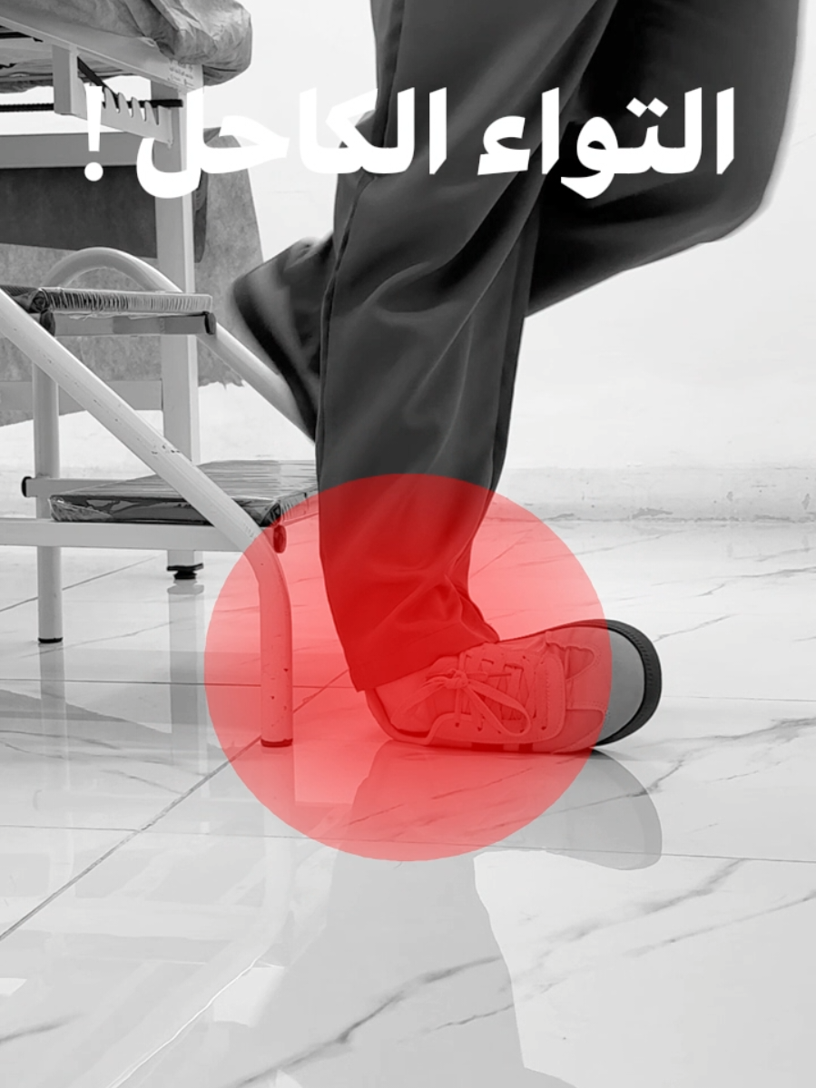 صار معك التواء الكاحل وكملت يومك ؟ شوف شو بصير داخل المفصل 🦵🦶 📍مركز العطف للعلاج الطبيعي في ماركا الشمالية مقابل مطاعم ينابيع الشام مجمع الفردوس التجاري الطابق الرابع  ☎️ 0790203887 #اكسبلورexplore #اكسبلور #ankle #physiotherapy #injury 