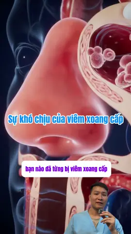Bạn nào đã từng bị viêm xoang cấp mới hiểu cảm giác #viemxoang #viemmuidiung #binhruamuitaka #bacsitoi 