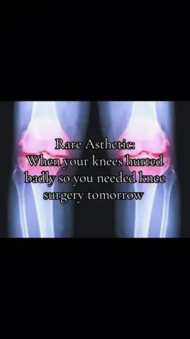 Knee surgery tomorrow 😔#fyp #fyppppppppppppppppppppppp #meme #kneesurgery #trending 