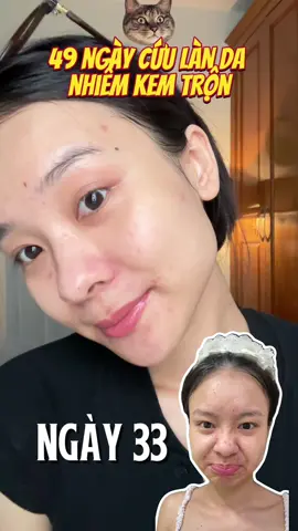 33/49 Da đẹp nhờ kiên trì, mà khổ cái tính mình thì hay lười 🥲 #trangcam #100ngaythaydoibanthan #damun #caryophy #caryophyvietnam