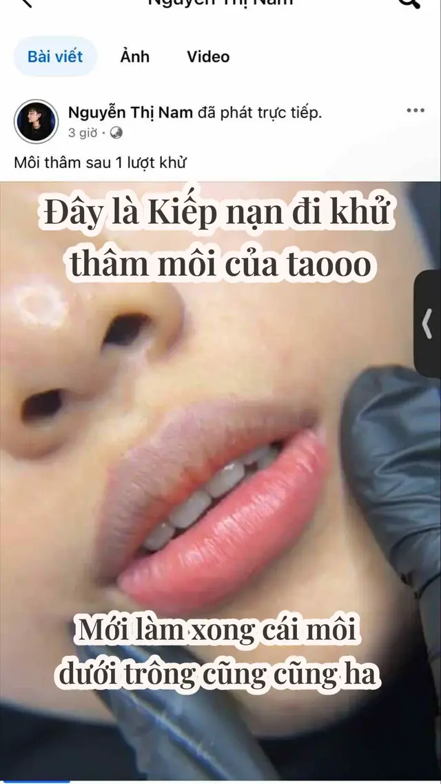 Ai đang có ý định đi khử thâm môi không 🤣 #khuthammoi 