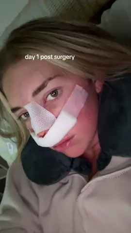 rhinoplasty & septo healing journey!! pineapple juice & icing the face will be your best friend. #fyp #rhinoplasty #foryou 