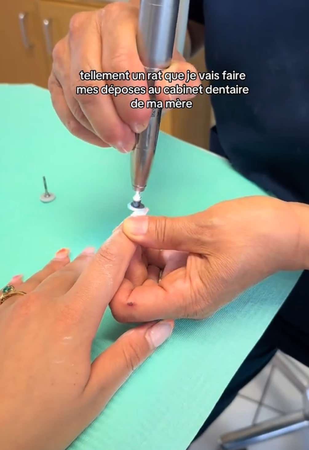 Dépose gratuite ! #nail #dentist 