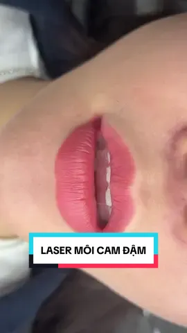 Laser Co2 môi bị đậm màu, tràn viền, lem mực ở mép môi cho em gái từng hút dung dịch nhiều lần !! #phunxamthanhhang #laserco2 #suamoihuhong #plasma #hutmucmoi 