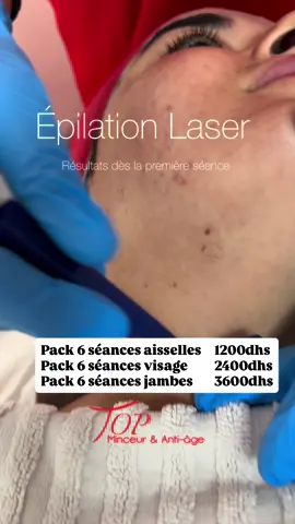 Épilation Laser   (4 longueurs d’ondes ) En commençant dès maintenant, vous profitez de tous les avantages : ✅ Un traitement en toute sécurité ✅ Des résultats visibles au fil des séances ✅ Une peau douce et nette prête pour le printemps et l’été ✅ Plus de liberté, moins de contraintes ✅ Un vrai gain de temps au quotidien   Top minceur et anti-âge  0522255360 / 0664491117 #epilationdefinitive #laserdiode #collagène #topminceur #cryolipolyse        