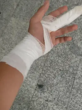yapcak bişi yok#fyppppppppppppppppppppppp#el#kırık