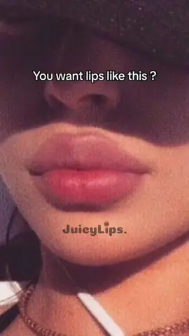 Mach’s wie über 53.000+ Girls und hol dir dein Lippenupgrade 👄✨