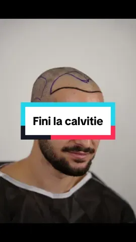 ✈️ 👨🏼‍🦲👉🏼🇹🇷👨🏻