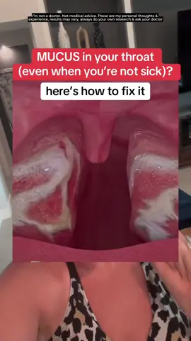 Chinese medicine refers to all this mucus being caused by something called “internal dampness” and found that interesting. Here’s some other info about how your gut health is connected to excess phlegm and mucus when you’re not sick. #phlegm #mucus #acidreflux #guthealth #healthandwellness 