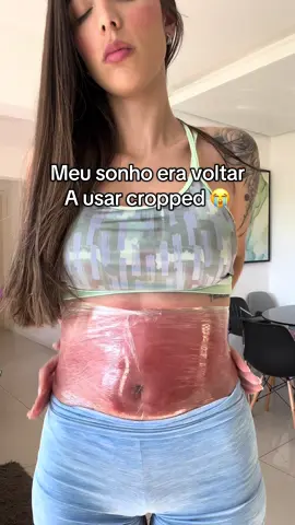 A melhor decisão foi começar a usar esse creme que regenerou a minha pele acabando com as estrias #estriasbrancas #estriasvermelhas #cremerosa 