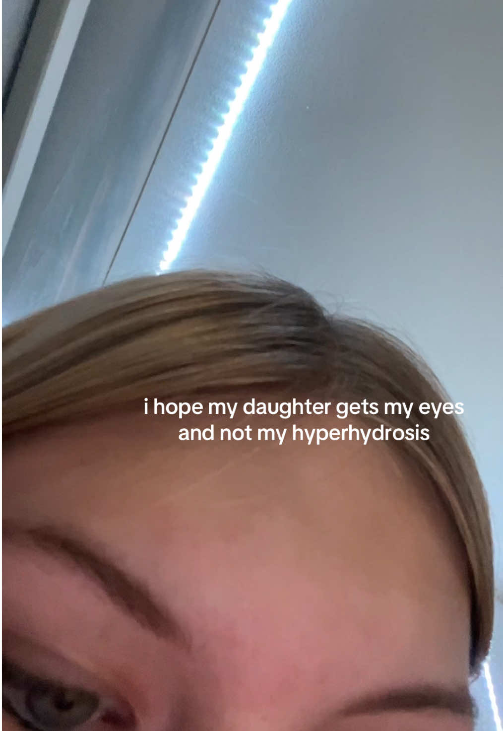 pls someone get this💔 #hyperhydrosis #relatable 