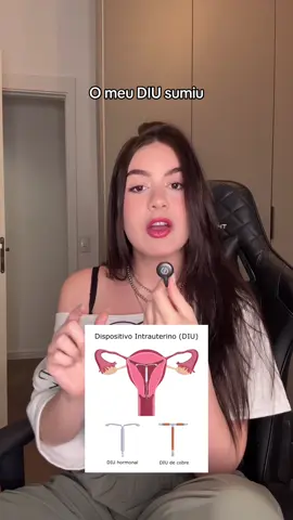 primeiro perdi o meu fone… agora meu DIU 