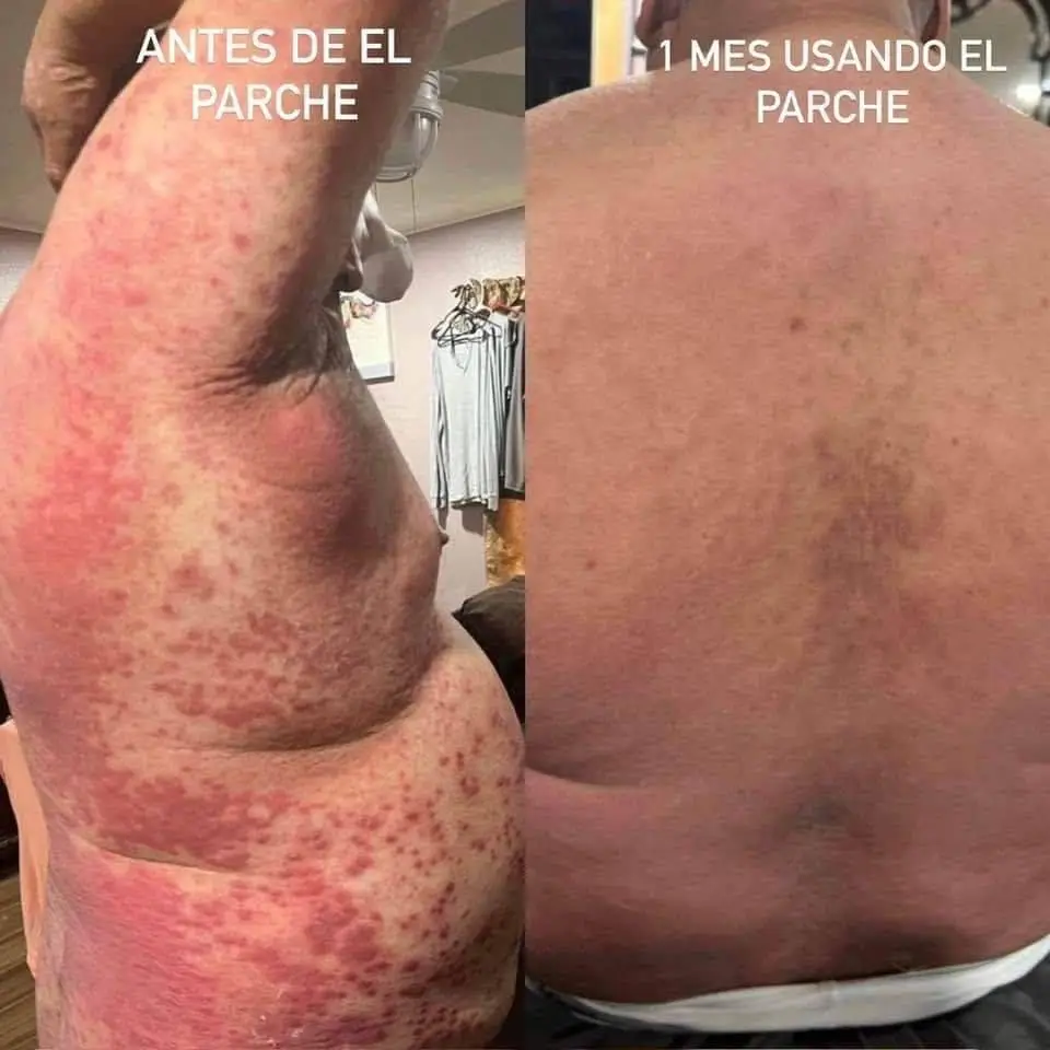 ✨Testimonios reales, resultados en poco tiempo✨ Los dispositivos X39 de LifeWave están transformando vidas con bienestar, energía y mejoras visibles. 🌿💫 #parati #fyp #viral  #parchesx39 