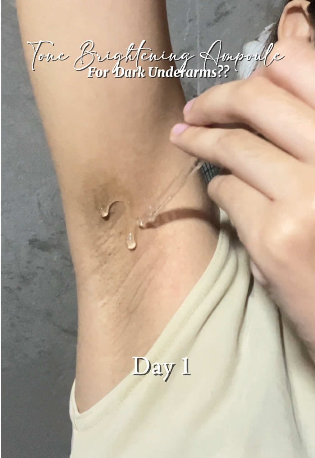 Swipe to see the difference 👀💫 Thanks to SKIN1004 Tone Brightening Ampoule, my underarms are visibly brighter, smoother, and more even-toned — in just 7 days! @skin1004philippines @user32653174601 @SKIN1004 US  #GoViralWithSKIN1004Challenge #SKIN1004RetinolShot  #skin1004 #centella #TikTokMadeMeBuyIt 