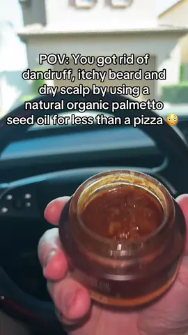 #dandruff #dryscalp #drybeard #dryhair 