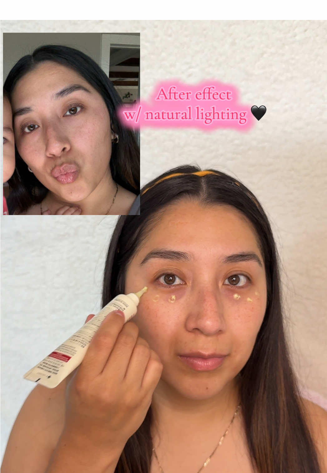 It’s not magic it’s the Seoul 1988 Eye Cream 😮‍💨✨ @KSECRET GLOBAL  ✨LINK: https://amzlink.to/az0gugolAM5Gc #ksecret #seoul1988 #retinal #eyecream #eyebags 