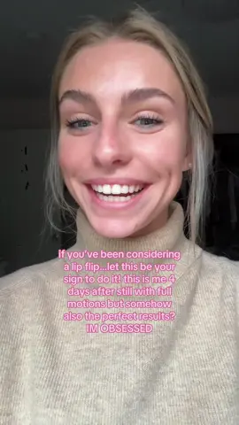 this is something i was self conscious about FOR YEARS! if you know me you know how obsessed i am #lipflip 