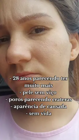 antes e depois da minha pele 😱✨️ testando sérum viral indicado aqui no tiktok 👉 #serumviral #antesedepois #skincarebrasil 