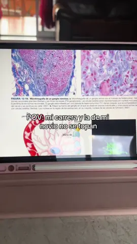 @emiltbm pero así nos complementamos jajajaja 😩❤️ #ingenieria #medicine #couple #novios #carrera 