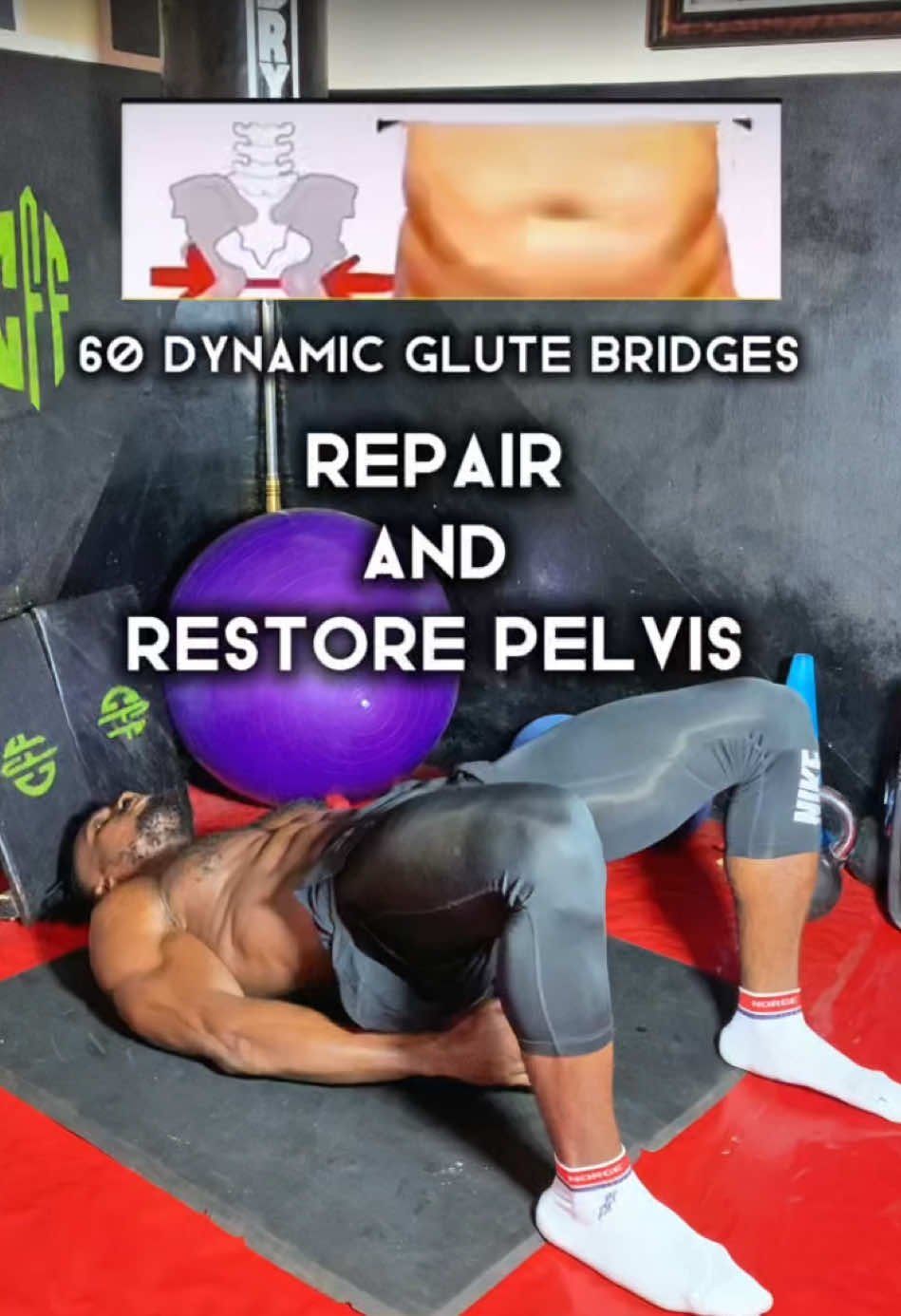 Repair and restore pelvic floor - easy home exercises #pelvicfloorphysicaltherapy #pelvicfloorhealth #pelvis #Kegelexercise #kegels   