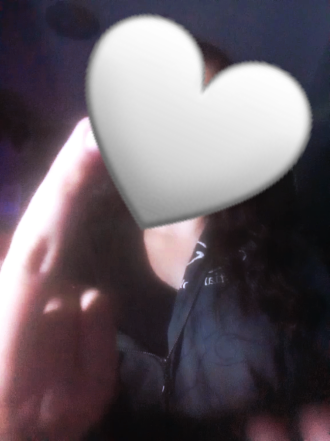 it's so swollen bruu @️ @️ @kate.12D @🥥🌚 