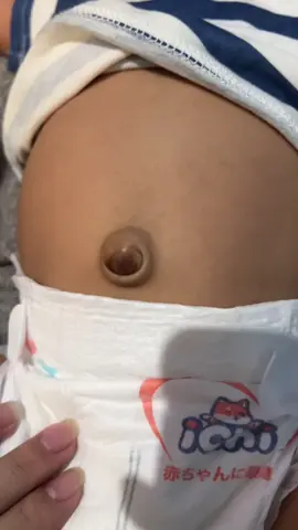 Iyakin kasi si baby kaya naka usli ang pusod nya pero buti na lang meron ng ganito. #herniabeltforbaby #babyproducts 