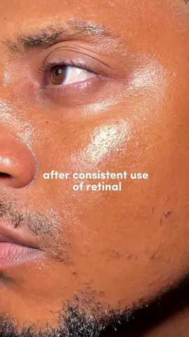 Now I get the hype for this retinal serum 🤍✨ consistency is really the key! #KSECRETGlowChallenge #KSECRET #Seoul1988 #Retinal 