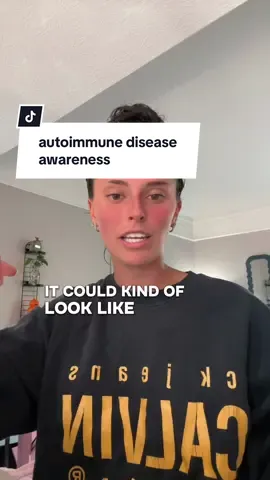 sorry this is a long vid but I always want to share and spread awareness because I know there’s others out there who struggle like I do! #lupus #autoimmunedisease #fyp #fypシ゚viral #lupusawareness #autoimmunedisorder 