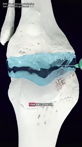 How Viscos Gel Injection Works for Knee Osteoarthritis (3D Animation) #3dmedicalanimation#medical3danimation#kneepain#viscosgel#kneeinjection