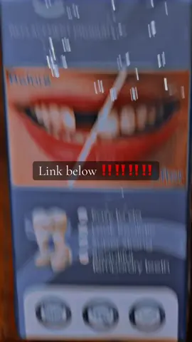 #teeth #forthegirls #fortheboys #DIY 