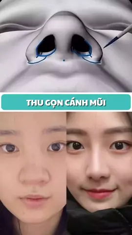 Thu gọn  tạo hình  cánh  mũi 