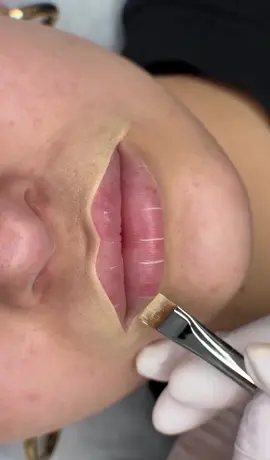 Lábios hidratados, volumosos e com brilho natural: esse é o poder do Hidragloss! Agora você pode aprender a técnica completa por apenas R$27,00. 📚 Curso 100% online, prático e acessível. 👉 Garanta já o seu no link da bio! #hydraglosslips #beleza #estetica #beauty #bocaperfeita💋    